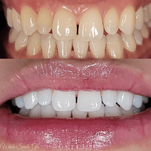 Purple Whitening Toothpaste 30ml everyday essentials